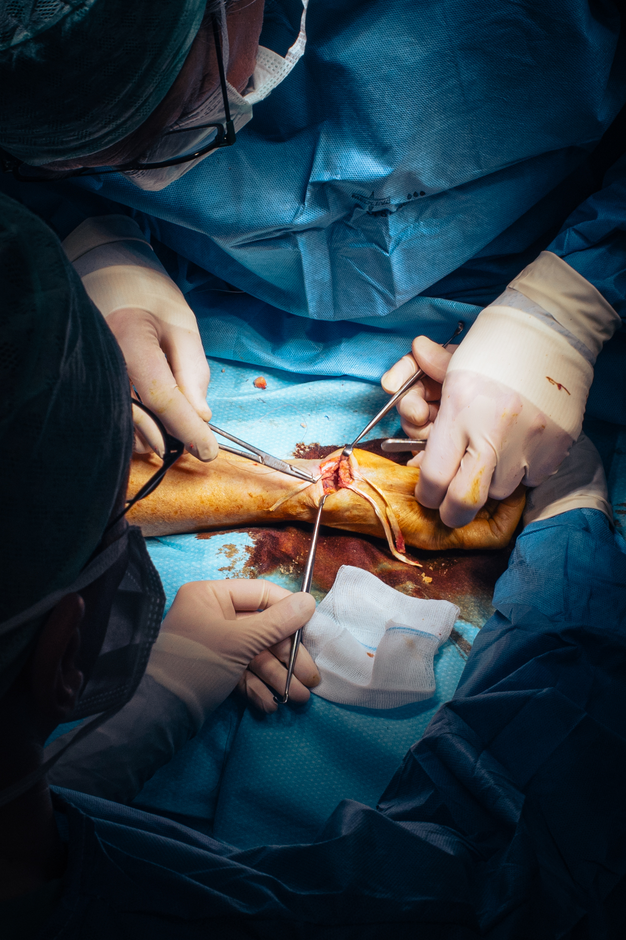 3 months in a surgery room.